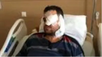 Avukata bıçakla saldırıp kör eden peruklu saldırgan, boşanma davasındaki müvekkilin kocası çıktı Avukata bıçakla saldırıp kör eden peruklu saldırgan, boşanma davasındaki müvekkilin kocası çıktı
