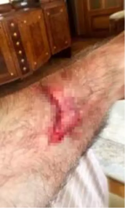 Beykoz'da komşusunu darp ettiği iddia edilen adam konuştu Beykoz'da komşusunu darp ettiği iddia edilen adam konuştu