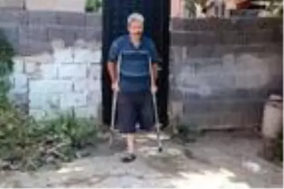 Bacağını kaybetti, gençleri uyardı: Benden ibret alın ve sigarayı bırakın Bacağını kaybetti, gençleri uyardı: Benden ibret alın ve sigarayı bırakın