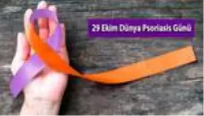 Sedef Hastalığının Etkileri Deriyle Sınırlı Kalmayabilir Sedef Hastalığının Etkileri Deriyle Sınırlı Kalmayabilir