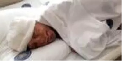 Son dakika haberleri! İlk ameliyatı olup iyileşti, sıradaki operasyonları bekliyor Son dakika haberleri! İlk ameliyatı olup iyileşti, sıradaki operasyonları bekliyor