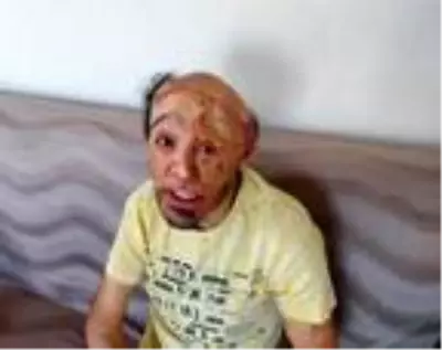 Son dakika haberleri! İlk ameliyatı olup iyileşti, sıradaki operasyonları bekliyor Son dakika haberleri! İlk ameliyatı olup iyileşti, sıradaki operasyonları bekliyor