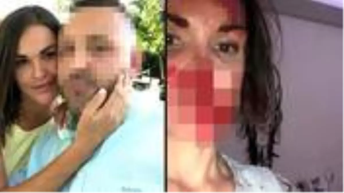 Rus güzellik uzmanı, barışma teklifini reddettiği eşi tarafından öldüresiye dövüldü