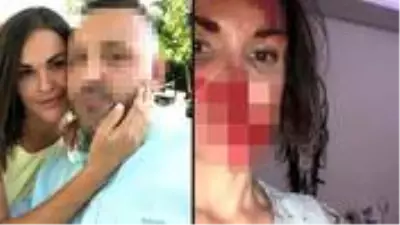 Rus güzellik uzmanı, barışma teklifini reddettiği eşi tarafından öldüresiye dövüldü Rus güzellik uzmanı, barışma teklifini reddettiği eşi tarafından öldüresiye dövüldü