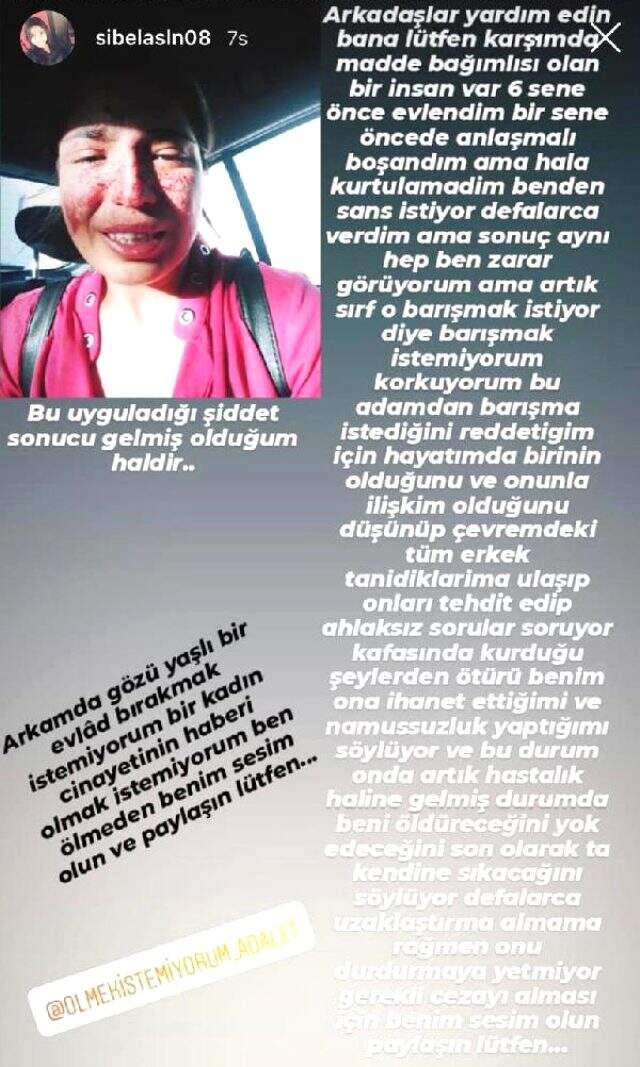 Boşandığı eşinden şiddet gören Sibel'in yardım çığlığı: Arkamda gözü yaşlı bir evlat bırakmak istemiyorum