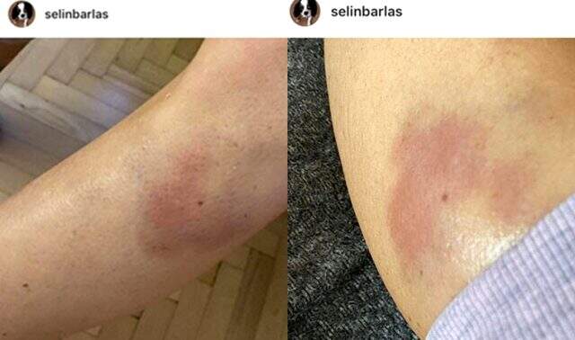 Selin Barlas, spor yorumcusu eşi Cem Dizdar'dan şiddet gördüğünü duyurdu Selin Barlas, spor yorumcusu eşi Cem Dizdar'dan şiddet gördüğünü duyurdu