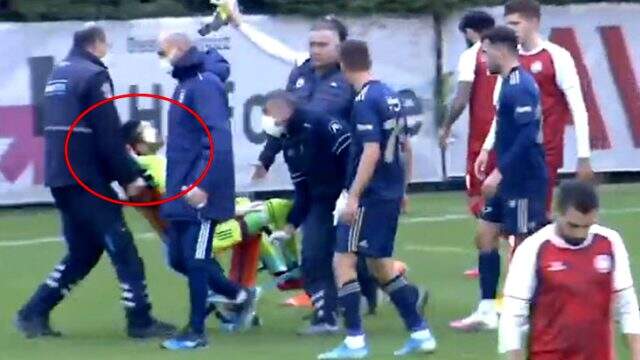 Fenerbahçeli kaleci Harun Tekin'in elmacık kemiği kırıldı