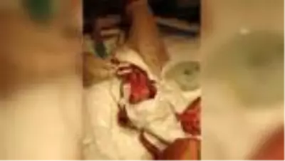 Erken doğan bebeklerin videosu Avrupa'da ödül aldı Erken doğan bebeklerin videosu Avrupa'da ödül aldı