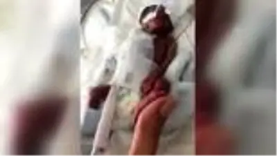 Erken doğan bebeklerin videosu Avrupa'da ödül aldı Erken doğan bebeklerin videosu Avrupa'da ödül aldı