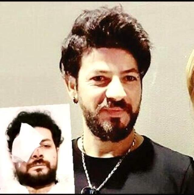 Genç müzisyen Şahan Dinç, maganda kurşunu yüzünden gözünü kaybetti Genç müzisyen Şahan Dinç, maganda kurşunu yüzünden gözünü kaybetti