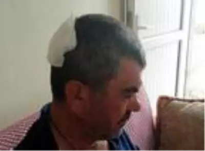 Patlamada savrulan taş parçaları 6 kişiyi yaraladı Patlamada savrulan taş parçaları 6 kişiyi yaraladı