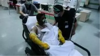 Yangında ailesini yanmaktan kurtardı, kendisi yanarak hastanelik oldu Yangında ailesini yanmaktan kurtardı, kendisi yanarak hastanelik oldu