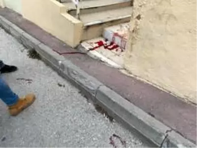 Son dakika haberleri... Kardeşi tarafından defalarca bıçaklanan abla yaşam mücadelesi veriyor