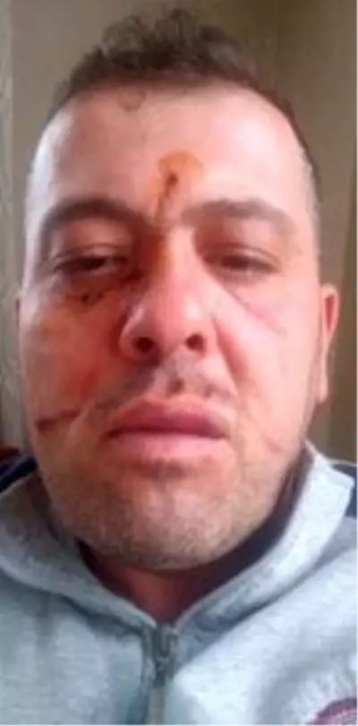 Son dakika haberi: Trafik magandası tarafından darbedilen ambulans şoförü: Tüm sağlık çalışanları adına şikayetçiyim Son dakika haberi: Trafik magandası tarafından darbedilen ambulans şoförü: Tüm sağlık çalışanları adına şikayetçiyim