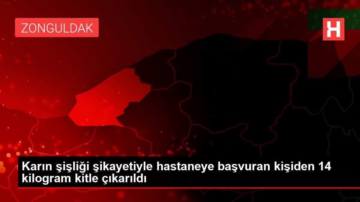 Karın şişliği şikayetiyle hastaneye başvuran kişiden 14 kilogram kitle çıkarıldı Karın şişliği şikayetiyle hastaneye başvuran kişiden 14 kilogram kitle çıkarıldı