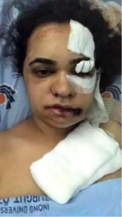 Son dakika haberi | Eşinin kendisini 4'üncü kattan attığı iddia edilen Firuze yaşadıklarını anlattı Son dakika haberi | Eşinin kendisini 4'üncü kattan attığı iddia edilen Firuze yaşadıklarını anlattı