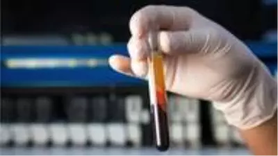 İngiltere'de 50'den fazla kanser türünü erken tespit etmesi umulan kan testi denenecek İngiltere'de 50'den fazla kanser türünü erken tespit etmesi umulan kan testi denenecek