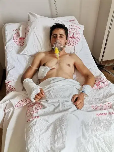 Ayı saldırısından yaralı kurtuldu, koronavirüsü de yendi Ayı saldırısından yaralı kurtuldu, koronavirüsü de yendi