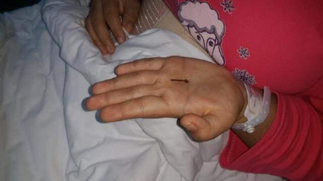 Genç kız, 1 yaşındayken yuttuğu toplu iğneden 17 yıl sonra kurtuldu Genç kız, 1 yaşındayken yuttuğu toplu iğneden 17 yıl sonra kurtuldu