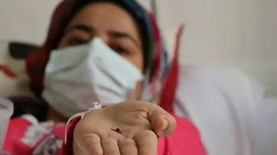 Genç kız, 1 yaşındayken yuttuğu toplu iğneden 17 yıl sonra kurtuldu Genç kız, 1 yaşındayken yuttuğu toplu iğneden 17 yıl sonra kurtuldu