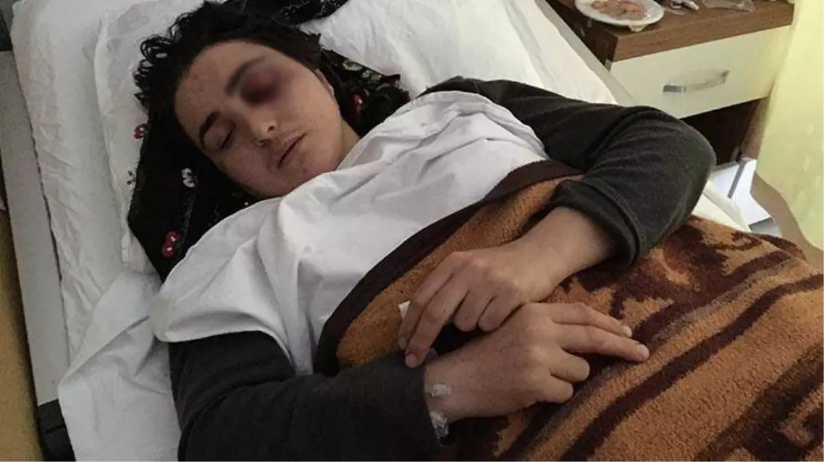 Koca şiddetiyle gözünü kaybeden Elif'ten 'iyi hal' indirimi tepkisi: Dünyam karardı, bu neyin indirimi?