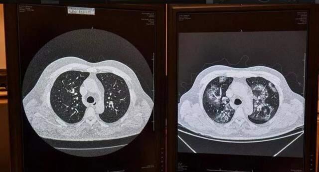 Koronavirüs tespitinde yeni yöntem! Artık belirti göstermeyen hastalar da tespit edilebilecek Koronavirüs tespitinde yeni yöntem! Artık belirti göstermeyen hastalar da tespit edilebilecek