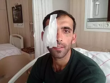 Atını kaçırarak işkence edenlerin dövdüğü çiftçinin gözünü kaybetme riski var Atını kaçırarak işkence edenlerin dövdüğü çiftçinin gözünü kaybetme riski var