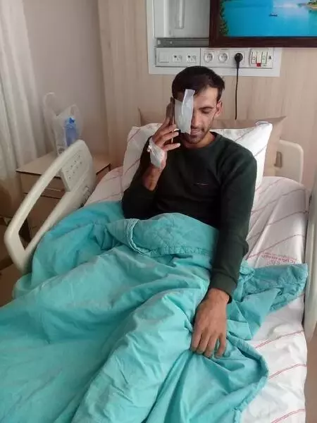 Atını kaçırarak işkence edenlerin dövdüğü çiftçinin gözünü kaybetme riski var Atını kaçırarak işkence edenlerin dövdüğü çiftçinin gözünü kaybetme riski var