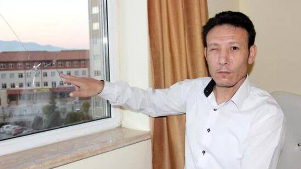 Sokaktan gelen ses nedeniyle camdan dışarı bakan vatandaş, bir gözünü kaybetti