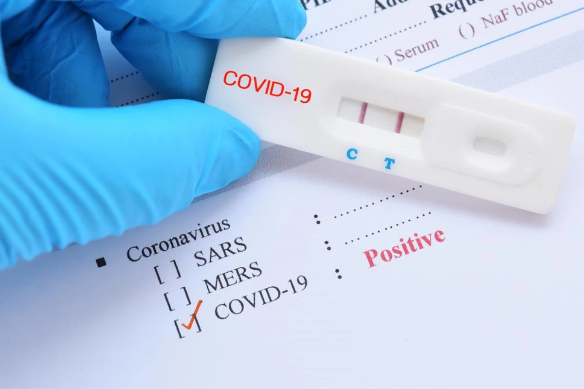 ucretsiz covid 19 koronavirus testi yapan hastaneler istanbul ankara izmir ve il il koronavirus testi yapan devlet hastaneleri nerede haberler