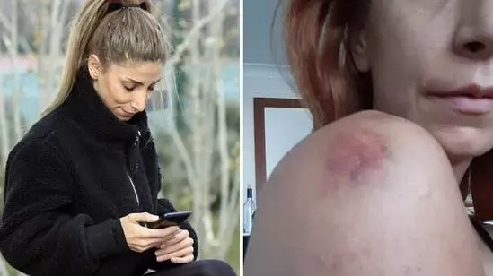 Sevgili şiddeti genç kadını canından bezdirdi: İşkence, sadistlik boyutundaydı Sevgili şiddeti genç kadını canından bezdirdi: İşkence, sadistlik boyutundaydı
