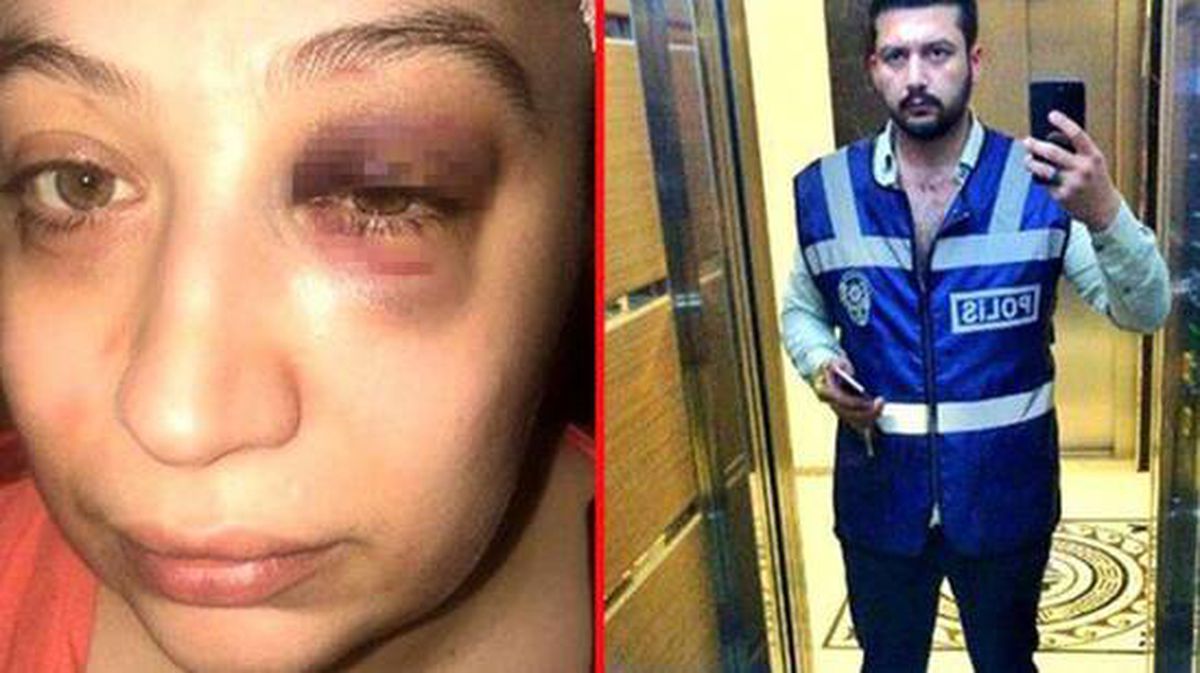 Eski eşini darbettiği iddiasıyla yargılanan sanığın tahliyesine karar verildi