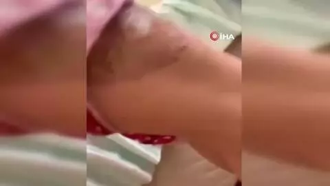 - Eşine kızgın bıçakla işkence eden koca hakim karşısına çıktı - Eşine kızgın bıçakla işkence eden koca hakim karşısına çıktı