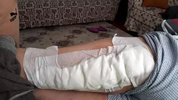Yaban domuzu saldıran çiftçinin bacağına 60 dikiş atıldı