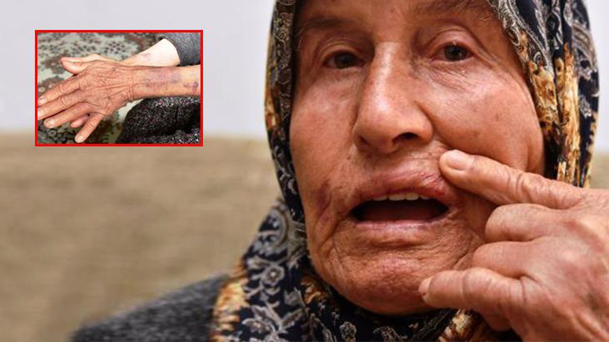Birkaç bilezik için yaşlı kadını kendi evinde darbettiler