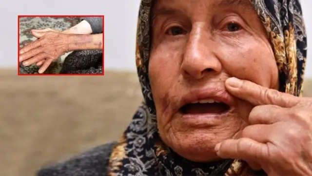 Birkaç bilezik için yaşlı kadını kendi evinde darbettiler Birkaç bilezik için yaşlı kadını kendi evinde darbettiler