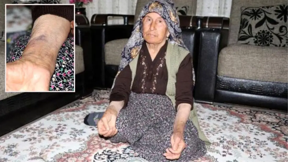 Vicdansızlar! Yaşlı kadına işkence edip bileziklerini gasp ettiler