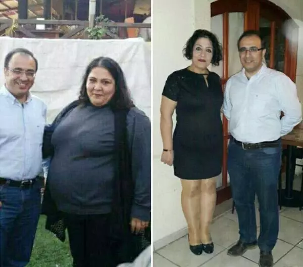 Anne ve oğlu, 'tüp mide' ameliyatıyla 140 kilo zayıfladı