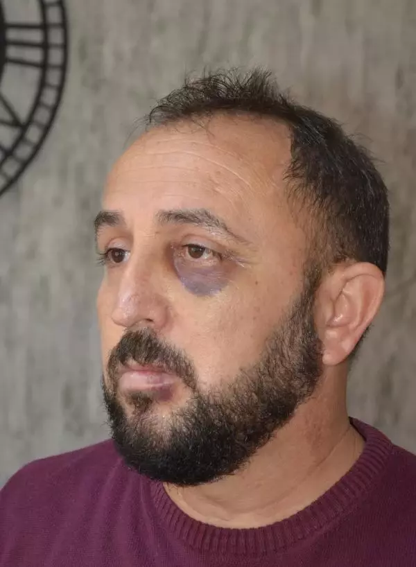 Okul müdürü, almak istediği evi başkasına satan emlakçıyı öldüresiye