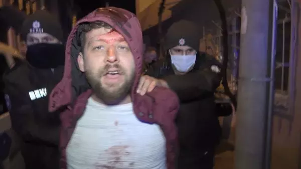 Son dakika haberi: Ağabeyini ve kendisini bıçakladı, teslim olmamak için polise direndi: 'Ben yaparım, beni tanıyan tanır' dedi Son dakika haberi: Ağabeyini ve kendisini bıçakladı, teslim olmamak için polise direndi: 'Ben yaparım, beni tanıyan tanır' dedi