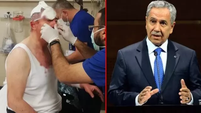 Arınç'tan saldırıya uğrayan Selçuk Özdağ'la ilgili açıklama: Bu kişileri azmettirenler asli failler gibi yargılanmalı Arınç'tan saldırıya uğrayan Selçuk Özdağ'la ilgili açıklama: Bu kişileri azmettirenler asli failler gibi yargılanmalı