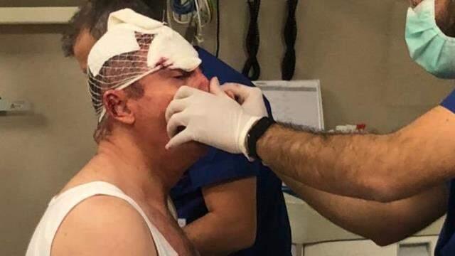 Selçuk Özdağ'dan evinin önündeki saldırı sonrası ilk açıklama: Beş kişiydiler, ikisi sopalarla vururken biri silah tutuyordu Selçuk Özdağ'dan evinin önündeki saldırı sonrası ilk açıklama: Beş kişiydiler, ikisi sopalarla vururken biri silah tutuyordu