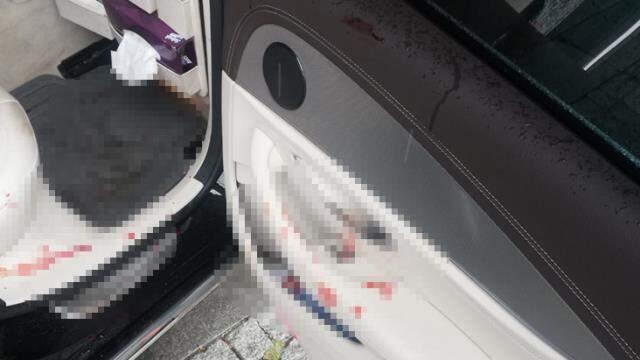 Selçuk Özdağ'dan evinin önündeki saldırı sonrası ilk açıklama: Beş kişiydiler, ikisi sopalarla vururken biri silah tutuyordu Selçuk Özdağ'dan evinin önündeki saldırı sonrası ilk açıklama: Beş kişiydiler, ikisi sopalarla vururken biri silah tutuyordu