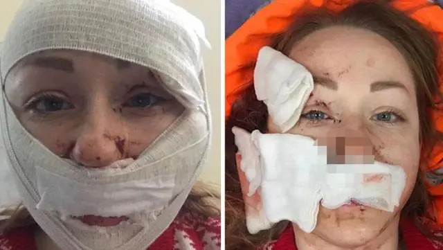 Boşanma aşamasındaki eşinin yüzünü falçatayla kesip tanınmaz hale getirdi! İfadesi diğer saldırganlardan farksız değil Boşanma aşamasındaki eşinin yüzünü falçatayla kesip tanınmaz hale getirdi! İfadesi diğer saldırganlardan farksız değil