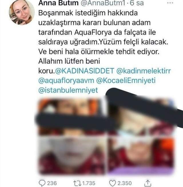 Saldırgan adam, boşanmak isteyen Ukraynalı eşi Anna Butim'in yüzünü falçatayla parçaladı Saldırgan adam, boşanmak isteyen Ukraynalı eşi Anna Butim'in yüzünü falçatayla parçaladı