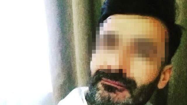 Saldırgan adam, boşanmak isteyen Ukraynalı eşi Anna Butim'in yüzünü falçatayla parçaladı Saldırgan adam, boşanmak isteyen Ukraynalı eşi Anna Butim'in yüzünü falçatayla parçaladı