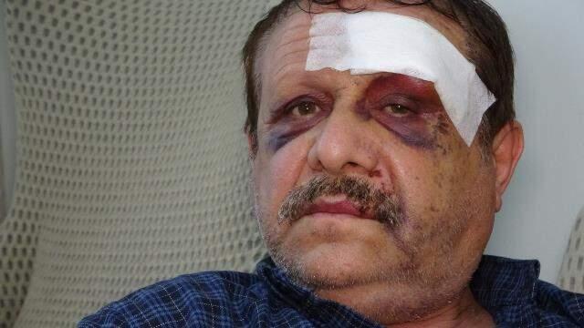 3 yıl önce iş yerine giren araçtan kıl payı kurtulan tamirci, bu defa da halk otobüsünün kopan tekerleği nedeniyle ölümden döndü 3 yıl önce iş yerine giren araçtan kıl payı kurtulan tamirci, bu defa da halk otobüsünün kopan tekerleği nedeniyle ölümden döndü