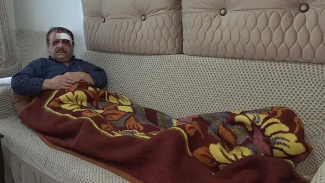 3 yıl önce iş yerine giren araçtan kıl payı kurtulan tamirci, bu defa da halk otobüsünün kopan tekerleği nedeniyle ölümden döndü 3 yıl önce iş yerine giren araçtan kıl payı kurtulan tamirci, bu defa da halk otobüsünün kopan tekerleği nedeniyle ölümden döndü