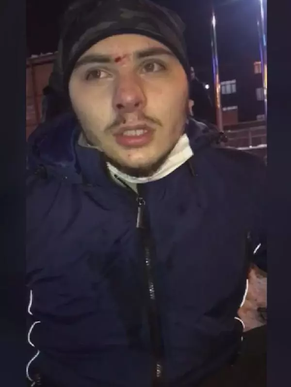 BUZDA KAYMAK İSTERKEN DÜŞTÜ, HAFIZA KAYBI YAŞADI BUZDA KAYMAK İSTERKEN DÜŞTÜ, HAFIZA KAYBI YAŞADI