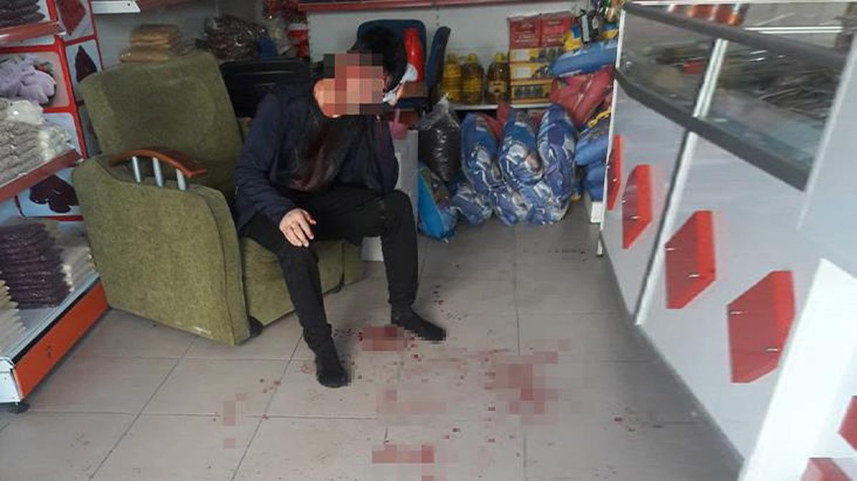 Gasp için gittikleri iş yerinde başarılı olamayınca esnafı 5 yerinden bıçakladılar